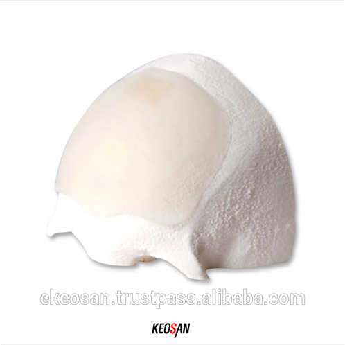 Forehead silicone implant